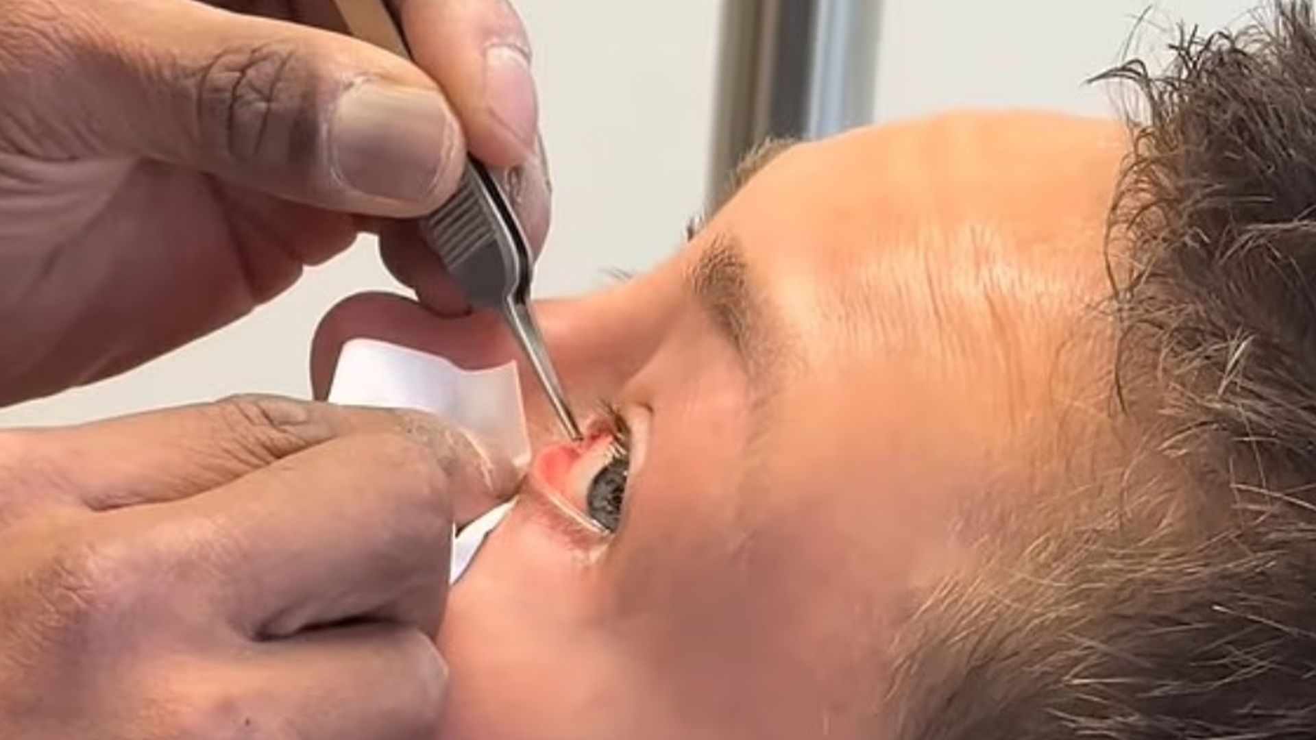 Rose Namajunas pokazuje szokujące skutki pchnięcia palcem w oko